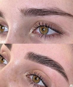 Alternative view of Kit Brow Lift Combinal